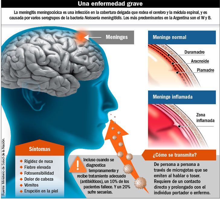 Infografía meningitis