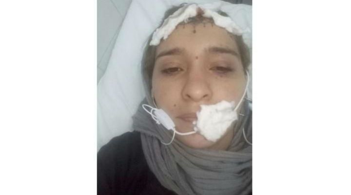 mujer golpeada en salta 04142018