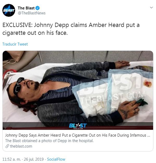 La prueba que presentó Johnny Depp contra su exesposa Amber Heard por haberlo quemado con un cigarrillo.