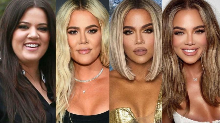 Khloé Kardashian - antes y después