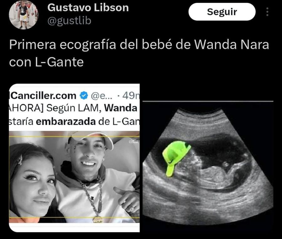 Los mejores memes sobre Wanda Nara y L-Gante