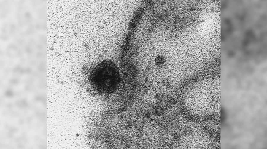coronavirus-infecta-una-celula-08042020-1