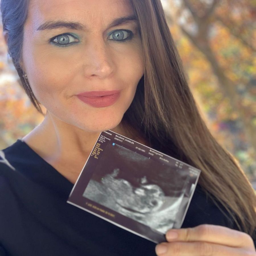 Angie Balbiani anunció que está embarazada | Caras
