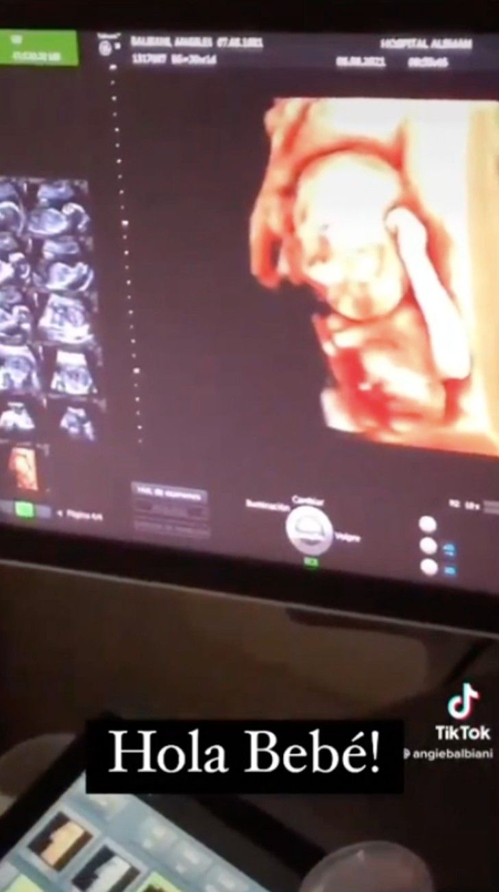 Angie Balbiani mostró la ecografía con la cara de su bebé