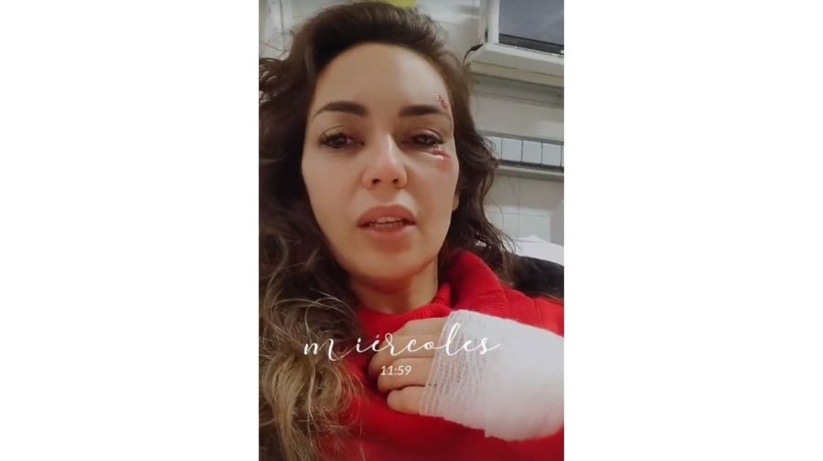 Natalia Gomez Gesualdi herida accidente