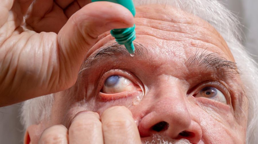 Glaucoma y estudios oculares 20220310