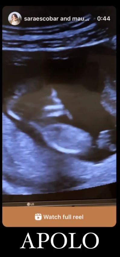 Mau Montaner y Sara Escobar anunciaron su primer embarazo