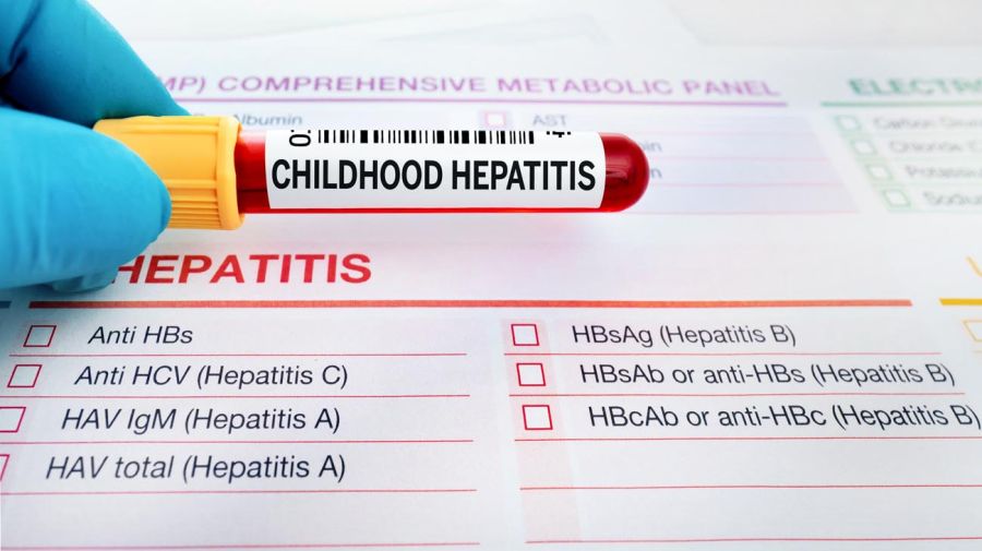 La hepatitis aguda infantil llegó a la Argentina: cuáles son los síntomas y cómo prevenirla