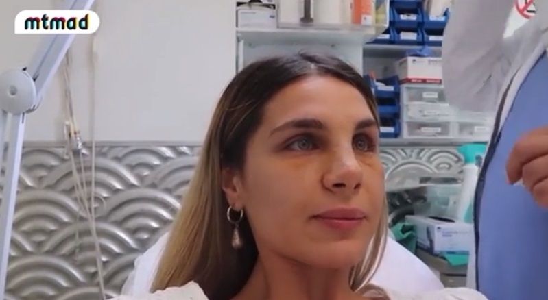 Ivana Icardi compartió los resultados de su operación de nariz: “¡Qué rara me veo!”