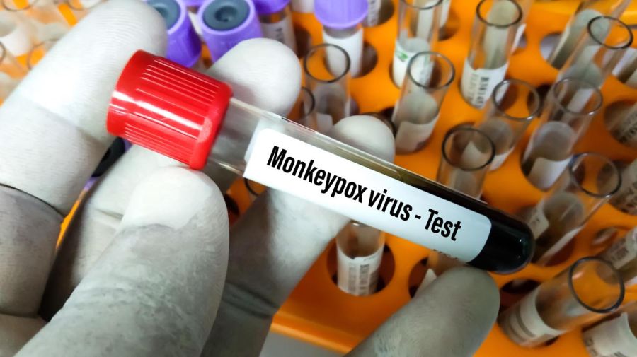 Second death from monkey smallpox in Argentina