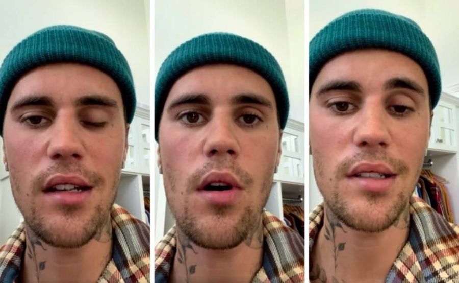 Justin Bieber sufrió una parálisis facial y preocupa su salud: “Manténganme en sus oraciones”