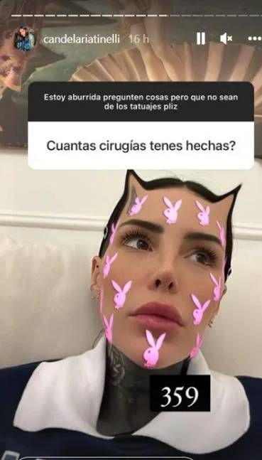 Cande Tinelli reveló el número exacto de cirugías que tiene