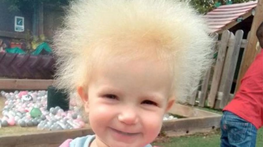 Layla Davis, de 17 meses, tiene el raro síndrome del cabello impeinable 20220725