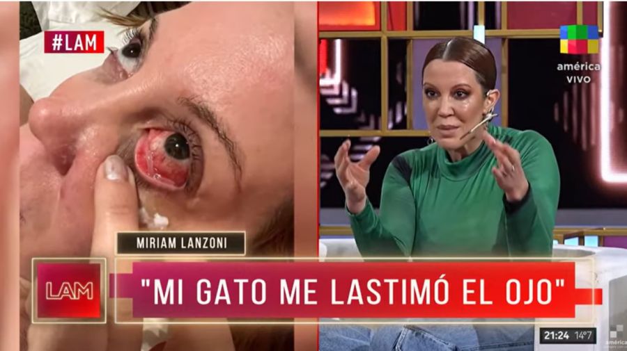 Accidente Miriam Lanzoni