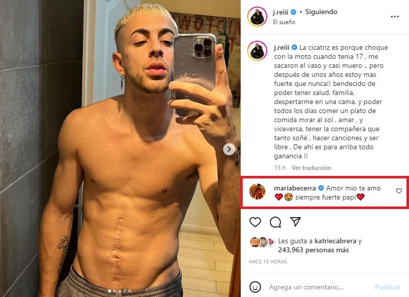 J Rei reveló a qué se debe la cicatriz que lleva en su abdomen: 