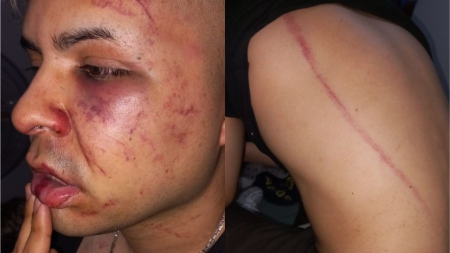 patovicas golpearon jovenes tucuman g_20220922