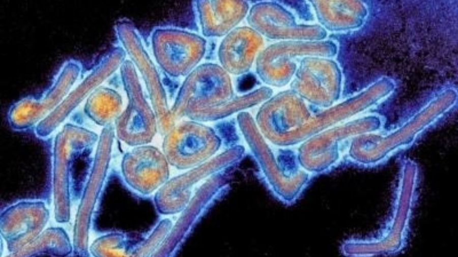 The 9 viruses that the WHO believes pose the most “urgent” threat to humanity