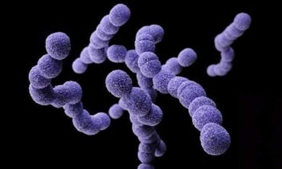Casos de Streptococcus pyogenes alarman al país 
