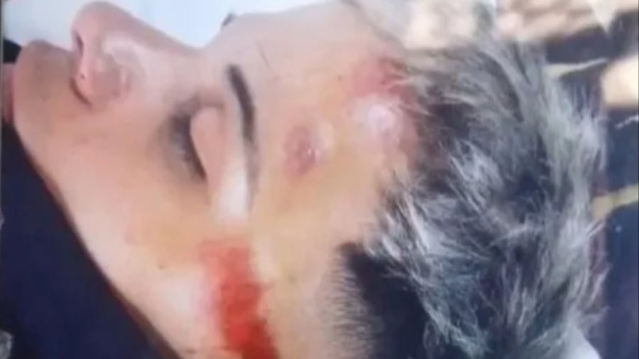 Brutal pelea a la salida de un boliche en Zárate: pateó en la cabeza a un adolescente g_20231030
