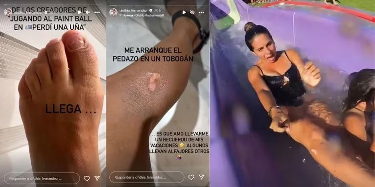 Cinthia Fernández sufrió un pequeño accidente