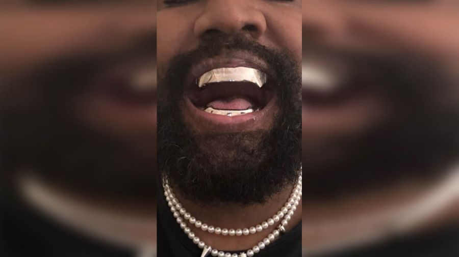los nuevos dientes de Kanye West