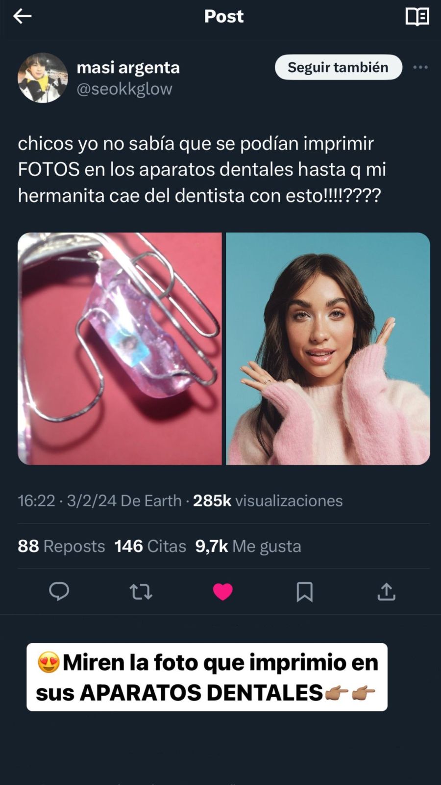 La reacción de María Becerra al ver que una fan la lleva en sus aparatos dentales