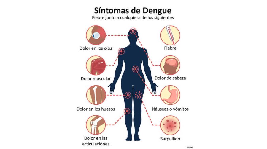 Síntomas de Dengue 20240226