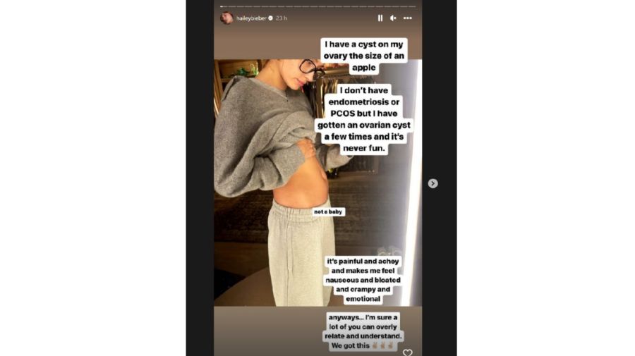Hailey Bieber respondió a los rumores de embarazo