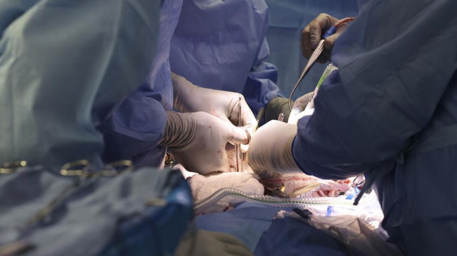 Un riñón de cerdo modificado genéticamente fue trasplantado con éxito