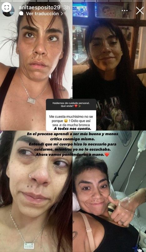 El increíble antes y después de Anita Espósito, la hermana de Lali Espósito