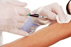 Un análisis de sangre podría detectar síntomas futuros de Alzheimer.