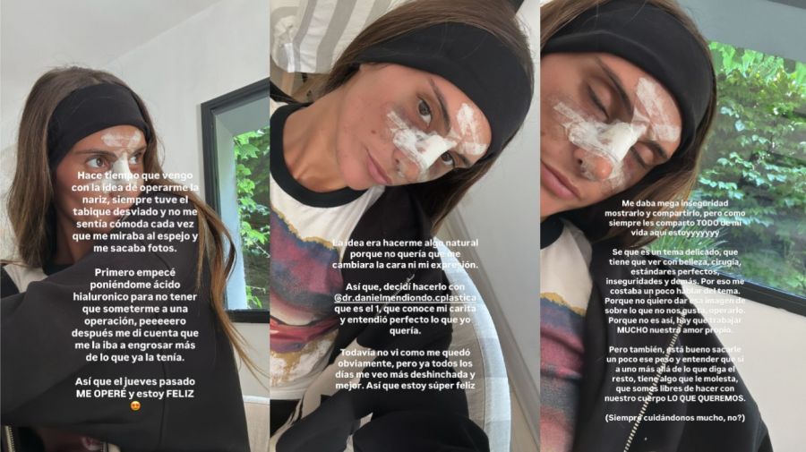 Lola Latorre se operó la nariz