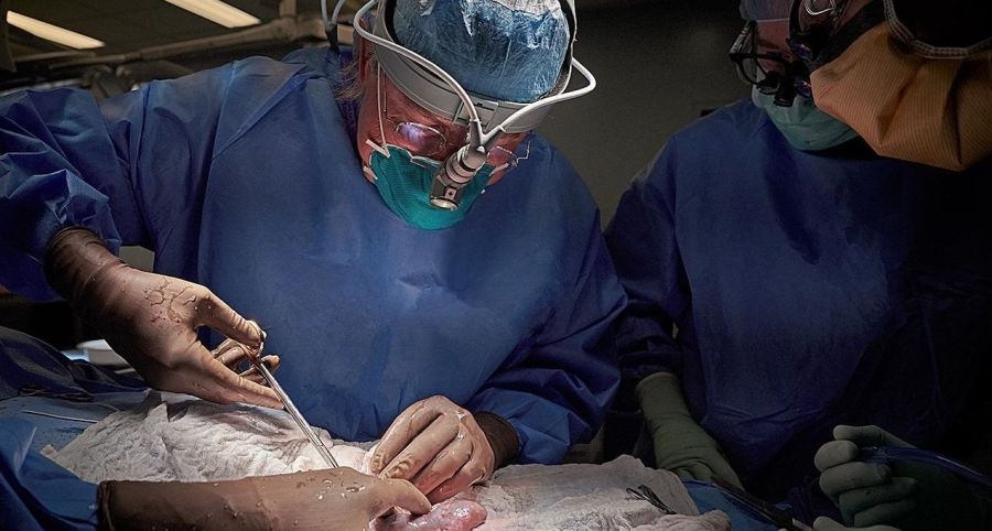 Dos estudios experimentales en Estados Unidos fueron alentadores para los xenotrasplantes. 