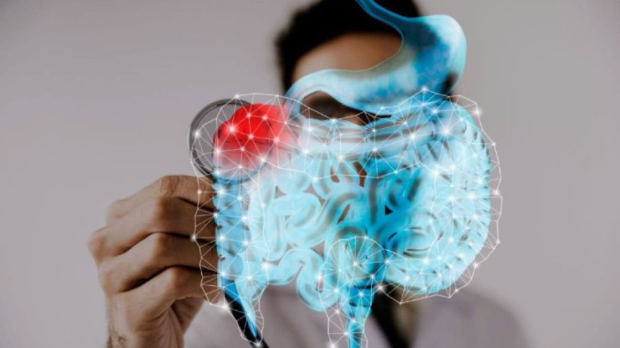 Microbiota intestinal