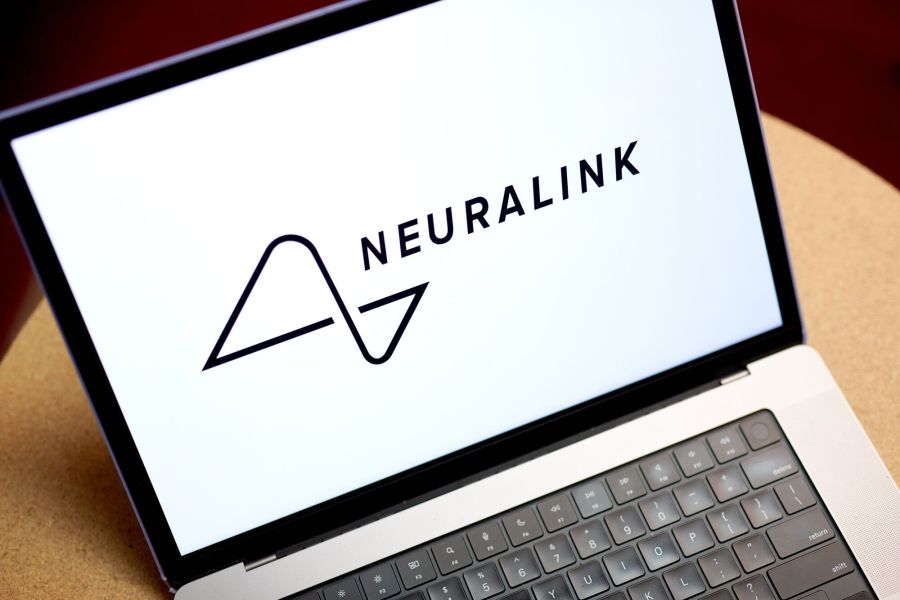 Musk Says First Neuralink Patient Received Implant In Brain 