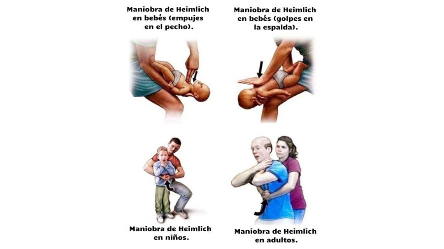 Maniobra de Heimlich