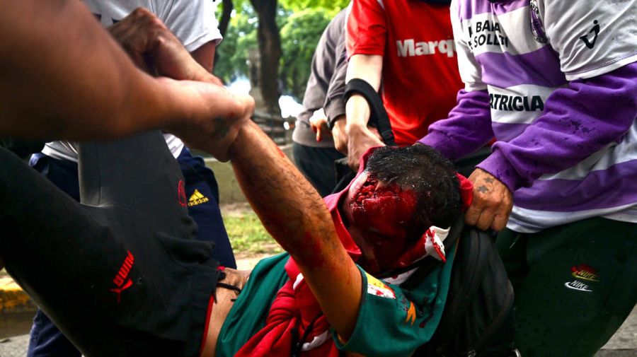  La marcha de los jubilados con los hinchas, la protesta en el Congreso 20250312