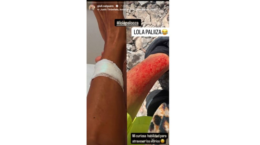 El tremendo accidente de Giuliana Salguero en el Lollapalooza