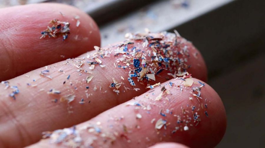 Microplásticos en el líquido folicular13052025