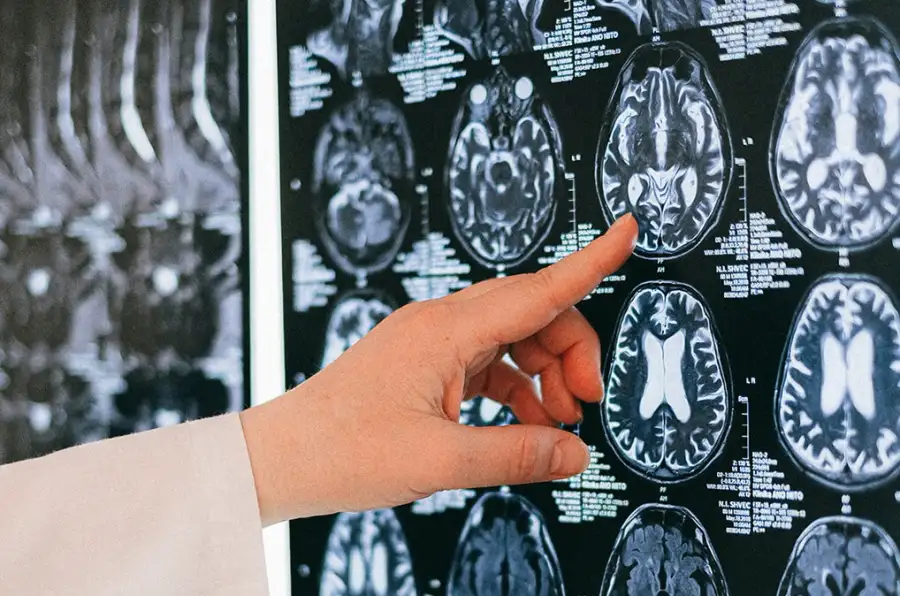 Neurocirujanos