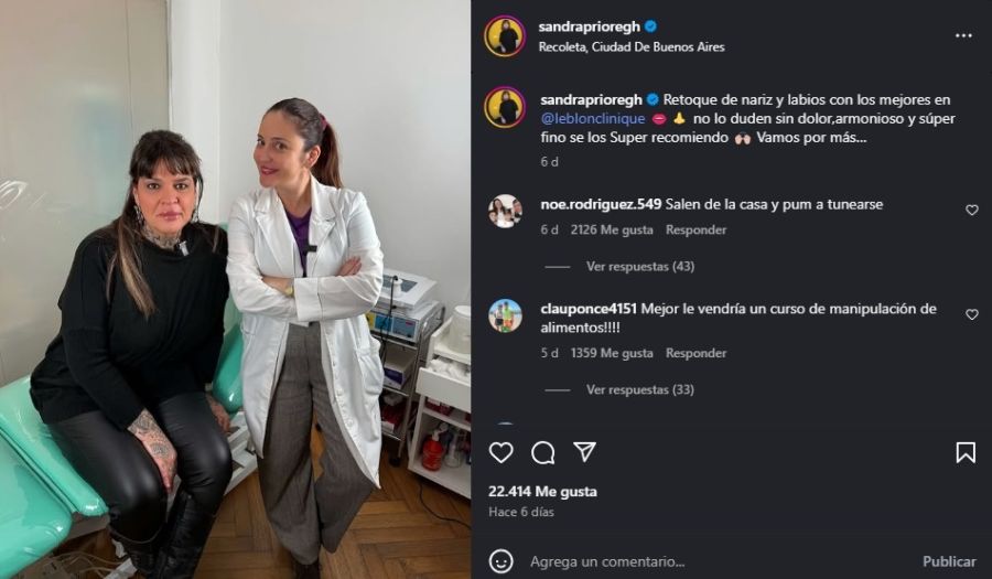 Sandra Priore de Gran Hermano se hizo un retoque estético
