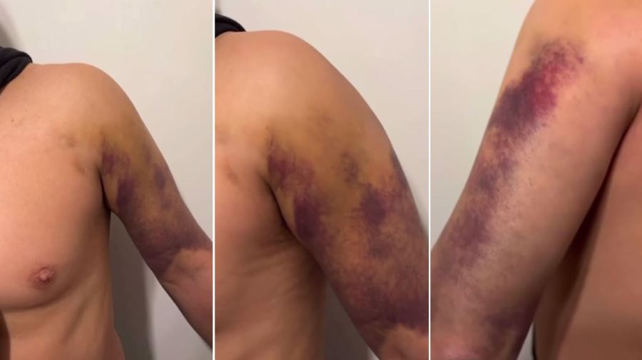 Accidente de Lio Pecoraro