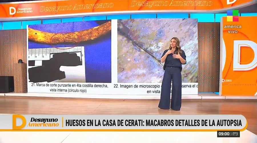 Restos Humanos en la casa que habitó Gustavo Cerati