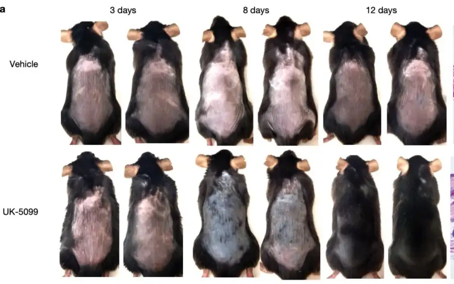 SOLUCIÓN-CAIDA-DEL-CABELLO