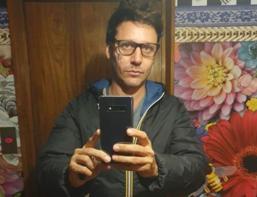 La revelación sobre la cicatriz de Benjamín Vicuña