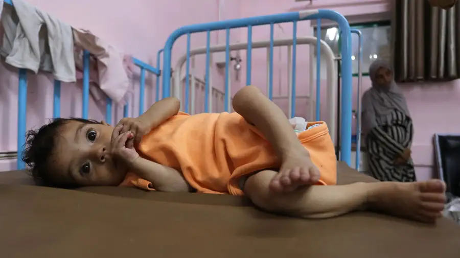 Desnutrición en Gaza 24072025