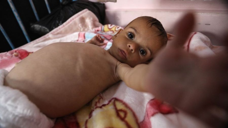 La ONU advierte hambruna en Gaza