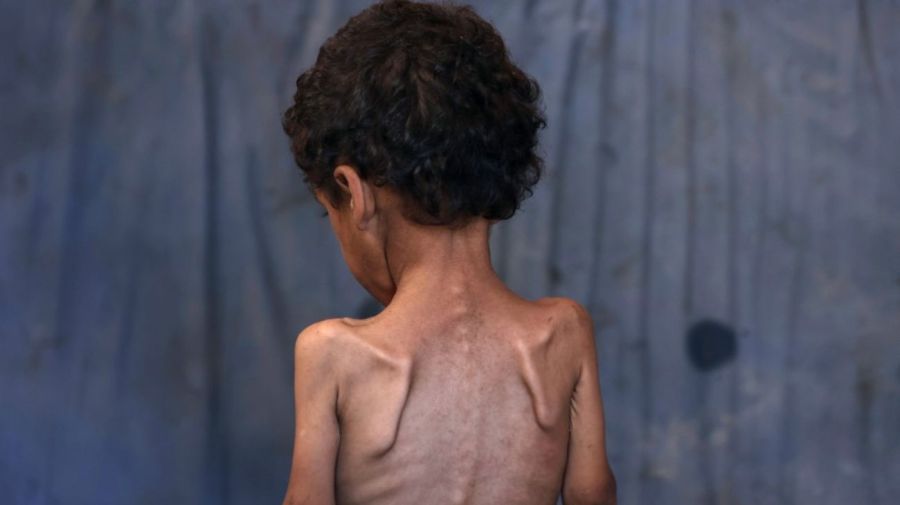 La ONU advierte hambruna en Gaza