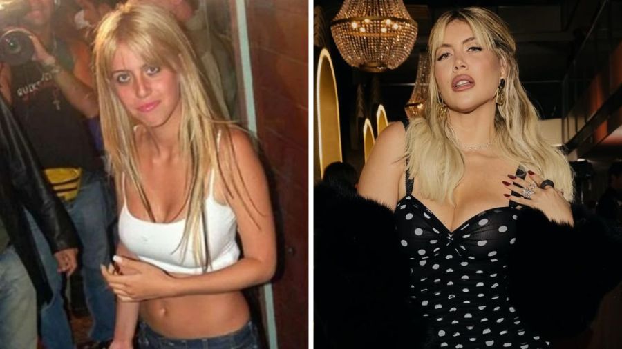 Antes y después de Wanda Nara