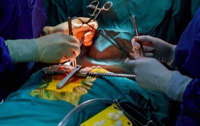  Donación de Órganos